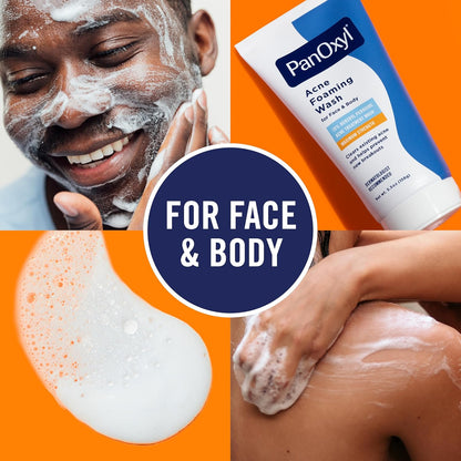 Benzoyl Peroxide Acne Foaming Wash, Maximum Strength, Daily Acne-Fighting Face and Body Cleanser, Face Wash to Clear, Treat and Prevent Acne Pimples and Stubborn Breakouts, 5.5 Oz Tube